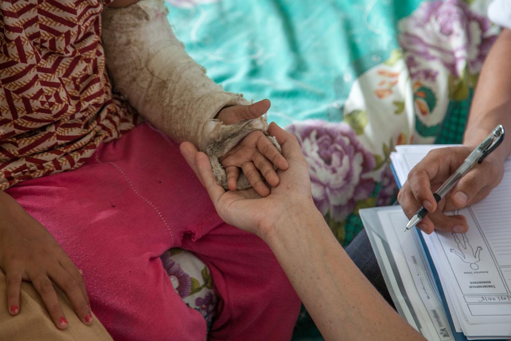DHUWAKOT-NEPAL---July-17-2015-A-physiotherapist-team-from-an-IMC-Mobile-Unit-perform-medical-checks-on-a-young-patient-with-a-broken-arm_WEb DHUWAKOT-NEPAL---July-17-2015-A-physiotherapist-team-from-an-IMC-Mobile-Unit-perform-medical-checks-on-a-young-patient-with-a-broken-arm_WEb