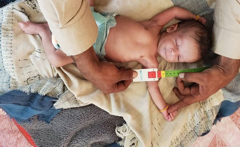 Community health and nutrition volunteer Hajer measures Abdullah’s mid-upper arm circumference (MUAC) on a home visit as she monitors his recovery from severe acute malnutrition with complications.